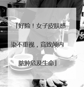好险！女子皮肤感染不重视，竟致颅内脓肿危及生命